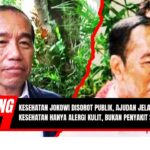 Doc. Presiden ke-7 Republik Indonesia, Joko Widodo, tampak dalam dua potret berbeda yang memperlihatkan kondisi wajahnya. Perubahan pada kulit wajah memicu perhatian publik dan spekulasi terkait kondisi kesehatannya. Ajudan Presiden memastikan bahwa Jokowi hanya mengalami alergi kulit ringan dan tidak menderita penyakit serius. (Sumber Foto: Tangkapan Layar iNews Youtube Chanel).