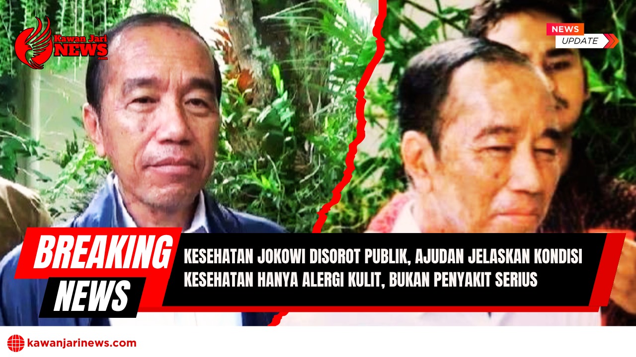 Doc. Presiden ke-7 Republik Indonesia, Joko Widodo, tampak dalam dua potret berbeda yang memperlihatkan kondisi wajahnya. Perubahan pada kulit wajah memicu perhatian publik dan spekulasi terkait kondisi kesehatannya. Ajudan Presiden memastikan bahwa Jokowi hanya mengalami alergi kulit ringan dan tidak menderita penyakit serius. (Sumber Foto: Tangkapan Layar iNews Youtube Chanel).