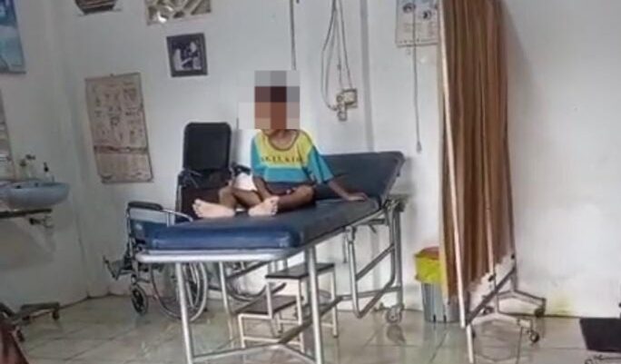 Doc. Seorang anak tengah menjalani perawatan medis di salah satu klinik setempat. Proses penanganan dilakukan oleh tenaga kesehatan sesuai prosedur medis untuk memastikan kondisi pasien tertangani dengan baik. Identitas dan wajah anak tidak ditampilkan secara jelas guna melindungi privasi serta hak anak sesuai prinsip perlindungan anak dan kode etik jurnalistik. (Foto: Dewan Guntur).