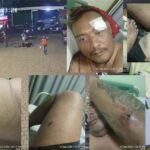Doc. Kolase dokumentasi dugaan penganiayaan terhadap M. Sholeh Abdullah Ali R. di Salatiga. Bagian foto memperlihatkan rekaman CCTV di area parkir serta kondisi korban dengan sejumlah luka pada tubuh setelah kejadian. Korban kemudian menjalani perawatan medis di RSUD Salatiga, sementara dugaan tindak kekerasan tersebut dilaporkan kepada pihak kepolisian untuk diproses sesuai ketentuan hukum.