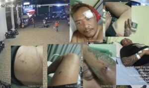 Korban Dugaan Penganiayaan dengan Linggis di Salatiga Dirawat di RSUD, FERADI WPI Dampingi Proses Hukum Doc. Kolase dokumentasi dugaan penganiayaan terhadap M. Sholeh Abdullah Ali R. di Salatiga. Bagian foto memperlihatkan rekaman CCTV di area parkir serta kondisi korban dengan sejumlah luka pada tubuh setelah kejadian. Korban kemudian menjalani perawatan medis di RSUD Salatiga, sementara dugaan tindak kekerasan tersebut dilaporkan kepada pihak kepolisian untuk diproses sesuai ketentuan hukum.