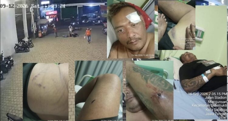 Doc. Kolase dokumentasi dugaan penganiayaan terhadap M. Sholeh Abdullah Ali R. di Salatiga. Bagian foto memperlihatkan rekaman CCTV di area parkir serta kondisi korban dengan sejumlah luka pada tubuh setelah kejadian. Korban kemudian menjalani perawatan medis di RSUD Salatiga, sementara dugaan tindak kekerasan tersebut dilaporkan kepada pihak kepolisian untuk diproses sesuai ketentuan hukum.