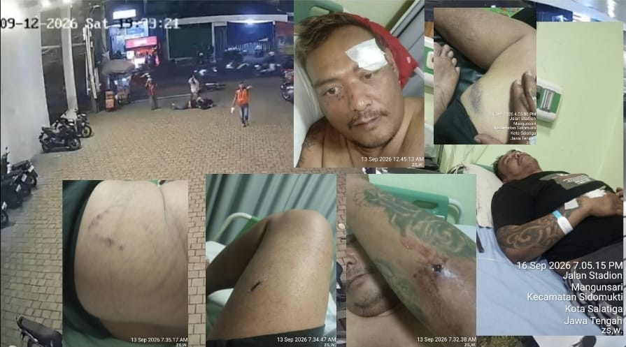 Doc. Kolase dokumentasi dugaan penganiayaan terhadap M. Sholeh Abdullah Ali R. di Salatiga. Bagian foto memperlihatkan rekaman CCTV di area parkir serta kondisi korban dengan sejumlah luka pada tubuh setelah kejadian. Korban kemudian menjalani perawatan medis di RSUD Salatiga, sementara dugaan tindak kekerasan tersebut dilaporkan kepada pihak kepolisian untuk diproses sesuai ketentuan hukum.
