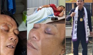 Perkelahian di Parkiran Benang Raja Salatiga, Kuasa Hukum Sebut Berawal dari Kesalahpahaman Dua Rekan Media Doc. Kolase foto memperlihatkan Fujiyanto saat menjalani perawatan setelah peristiwa perkelahian di area parkir Toko Benang Raja, Salatiga, serta Sukindar, S.H., C.PFW., C.MDF., C.JKJ., C.FTAX., selaku pimpinan Sukindar Law Firm yang mendampingi Fujiyanto dalam proses hukum perkara tersebut. Tim hukum menyatakan akan mengawal proses penanganan perkara serta mengupayakan penyelesaian melalui mediasi dan pendekatan kekeluargaan sesuai ketentuan yang berlaku.