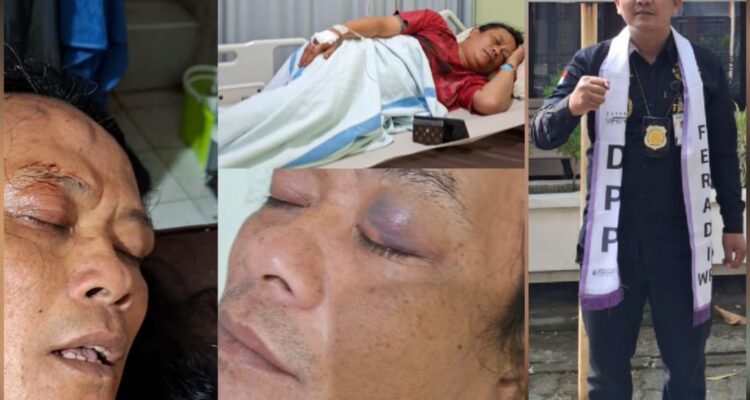 Doc. Kolase foto memperlihatkan Fujiyanto saat menjalani perawatan setelah peristiwa perkelahian di area parkir Toko Benang Raja, Salatiga, serta Sukindar, S.H., C.PFW., C.MDF., C.JKJ., C.FTAX., selaku pimpinan Sukindar Law Firm yang mendampingi Fujiyanto dalam proses hukum perkara tersebut. Tim hukum menyatakan akan mengawal proses penanganan perkara serta mengupayakan penyelesaian melalui mediasi dan pendekatan kekeluargaan sesuai ketentuan yang berlaku.