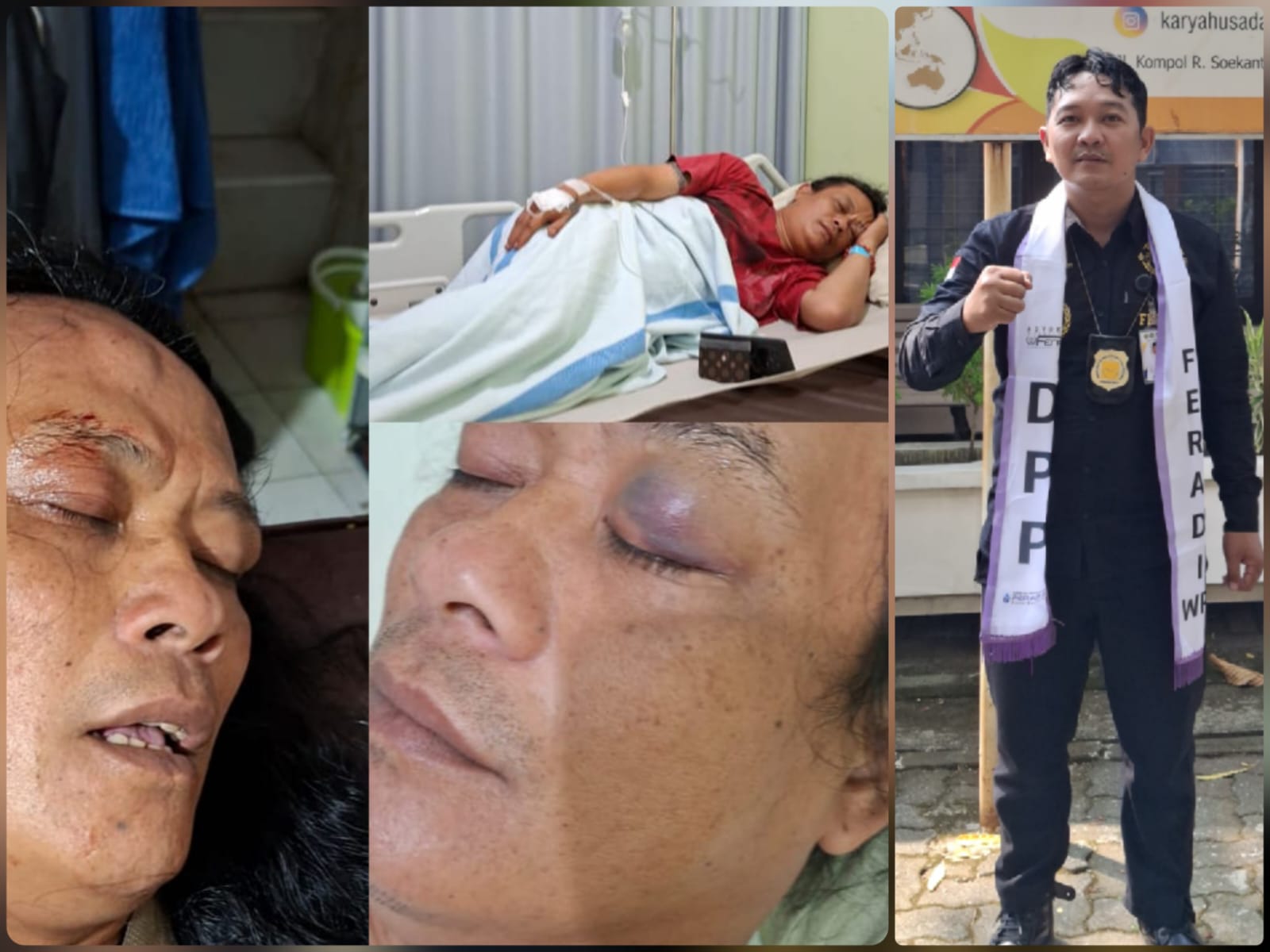 Doc. Kolase foto memperlihatkan Fujiyanto saat menjalani perawatan setelah peristiwa perkelahian di area parkir Toko Benang Raja, Salatiga, serta Sukindar, S.H., C.PFW., C.MDF., C.JKJ., C.FTAX., selaku pimpinan Sukindar Law Firm yang mendampingi Fujiyanto dalam proses hukum perkara tersebut. Tim hukum menyatakan akan mengawal proses penanganan perkara serta mengupayakan penyelesaian melalui mediasi dan pendekatan kekeluargaan sesuai ketentuan yang berlaku.