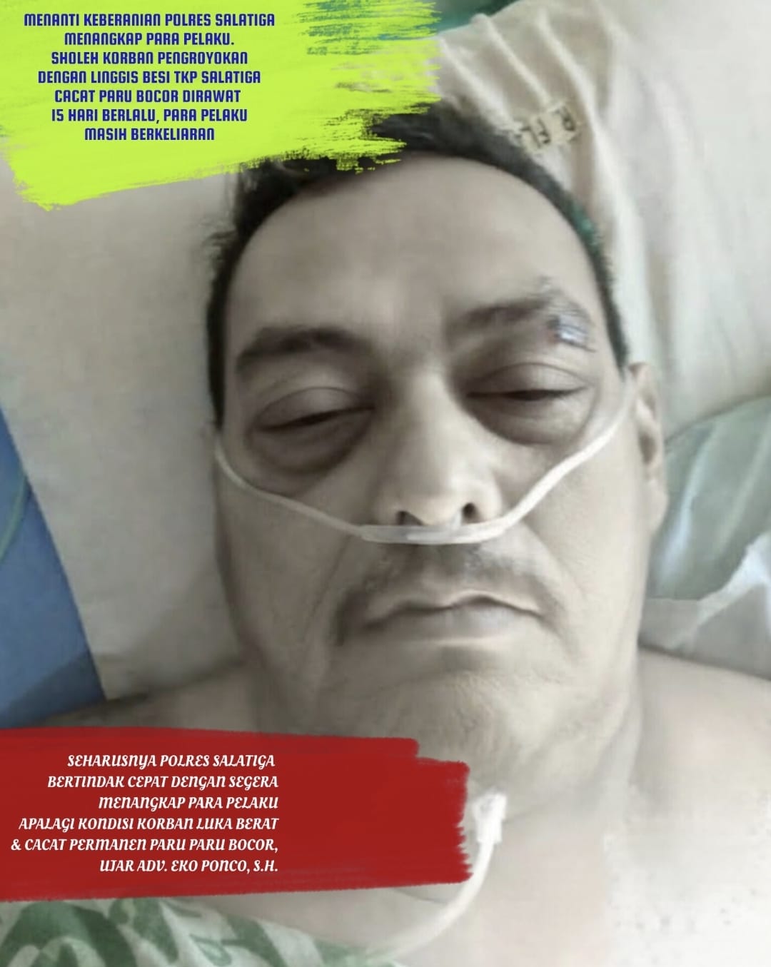 Doc. M. Sholeh Abdullah R. saat menjalani perawatan di rumah sakit di Salatiga, Sabtu (26/9/2026), setelah mengalami dugaan kekerasan di area parkir Toko Benang Raja pada 12 September 2026. Berdasarkan keterangan tim pendamping, korban masih menjalani perawatan medis dan memerlukan sejumlah tindakan serta alat bantu medis. Kondisi medis korban dalam foto merupakan bagian dari penanganan perawatan dan tidak menjadi kesimpulan medis redaksi.