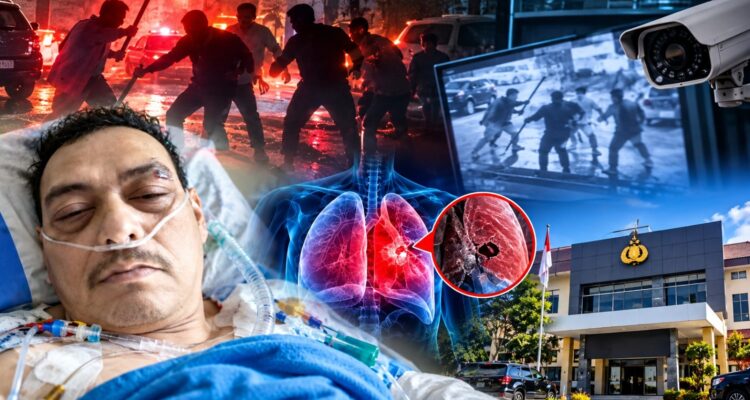 Doc. Foto ilustrasi kompilasi yang menggambarkan penanganan dugaan pengeroyokan terhadap M. Sholeh Abdullah R. di Salatiga. Ilustrasi menampilkan korban yang sedang menjalani perawatan di rumah sakit, gambaran rekaman CCTV saat dugaan kejadian, ilustrasi kondisi paru-paru, serta representasi kantor kepolisian sebagai simbol proses penanganan perkara. Ilustrasi ini dibuat untuk kepentingan pemberitaan dan bukan merupakan dokumentasi langsung atau bukti visual yang menggambarkan keseluruhan peristiwa secara faktual.